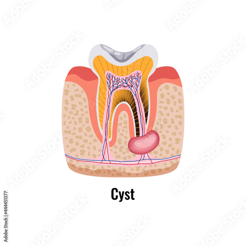 Dental Problem Poster