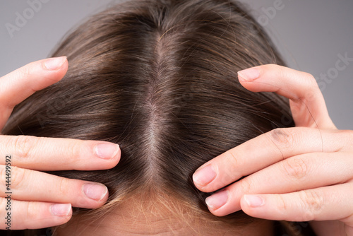 Woman worried about hair loss. Hair fall problem.