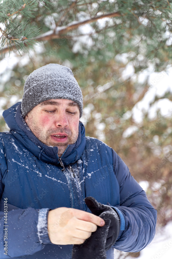 frozen Caucasian man with red cheeks and snow on eyelashes puts on gloves