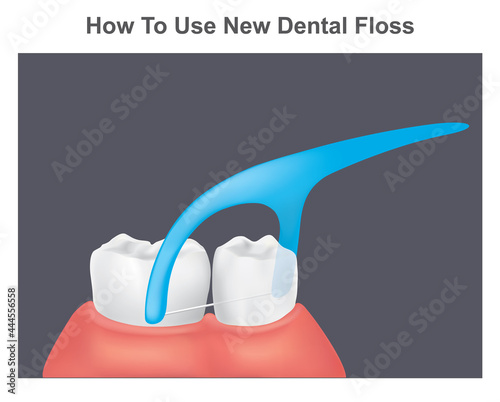 How to use new dental floss. Illustration healthy teeth and gums by using new dental floss..