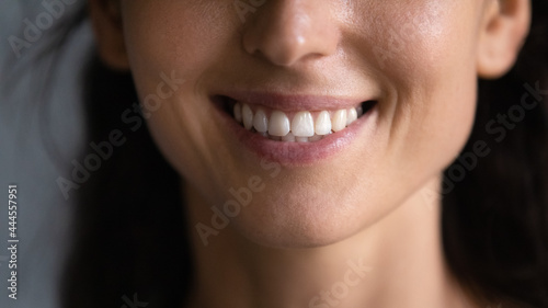 Photos Cropped shot of mouth and toothy smile close up