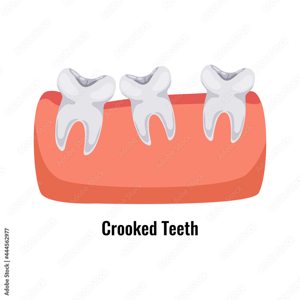 Obraz premium Dental Problem Poster