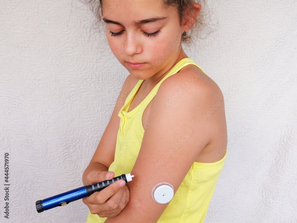 Girl stands and injects insulin from insulin pen in arm. On the arm is also  placed white sensor for continuous glucose monitoring in blood - CGM.  Diabetes type 1. Insulin dependent Stock