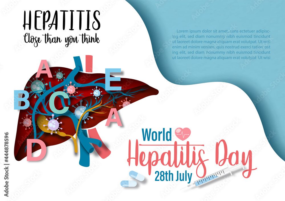 Hepatitis Lettering A human liver with English letters and hepatitis virus symbols, wording ...