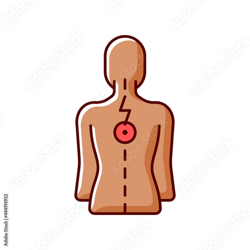 Pressure on spinal nerves RGB color icon. Muscle spasms. Pain between shoulder blades. Numbness, tingling. Damage to spinal cord. Vertebrae dislocation. Upper back pain. Isolated vector illustration