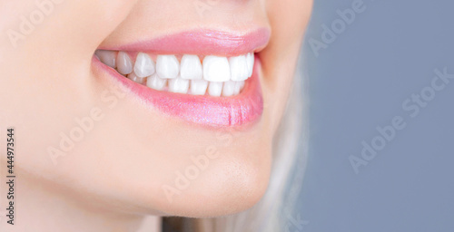 Dental care. Dentistry concept. Perfect healthy teeth. Closeup shot of woman's toothy smile. Perfect healthy teeth smile woman. Teeth Whitening. Dental health Concept. Teeth whitening procedure