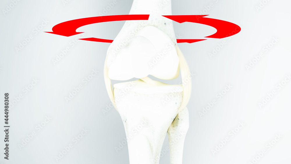 Knee surgery, torn tendon repair, ligament repair, pins, bone drilling