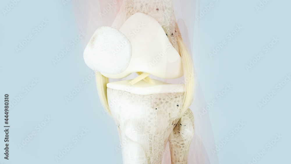 Knee surgery, torn tendon repair, ligament repair, pins, bone drilling