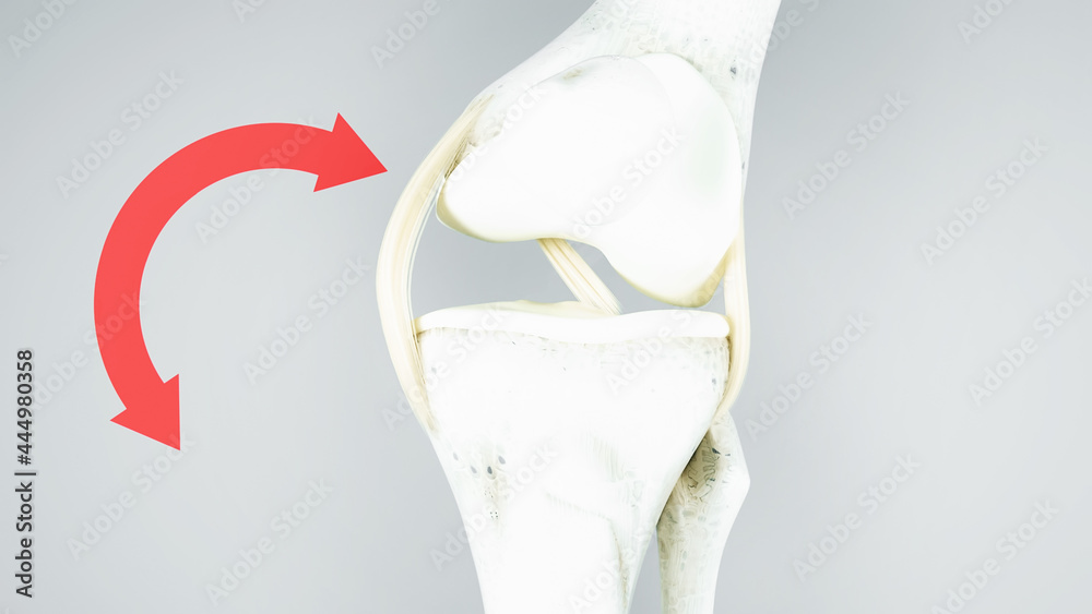 Knee surgery, torn tendon repair, ligament repair, pins, bone drilling