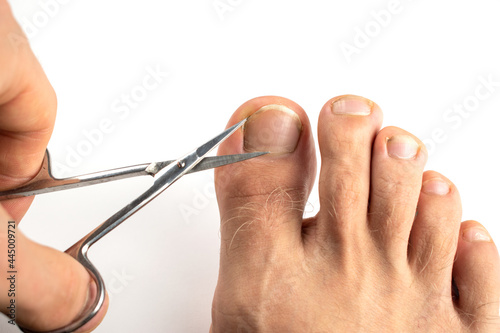 The guy cuts his toenails with scissors. photo