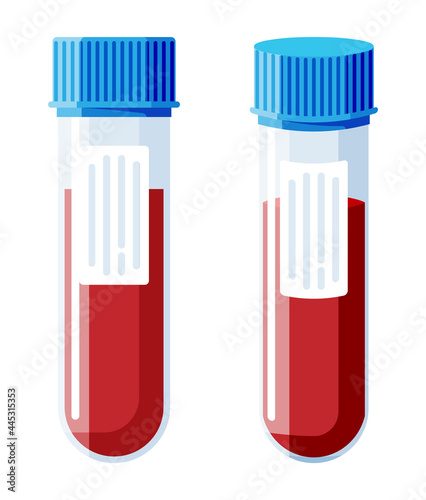 Test Tube with Blood Sample Isolated.