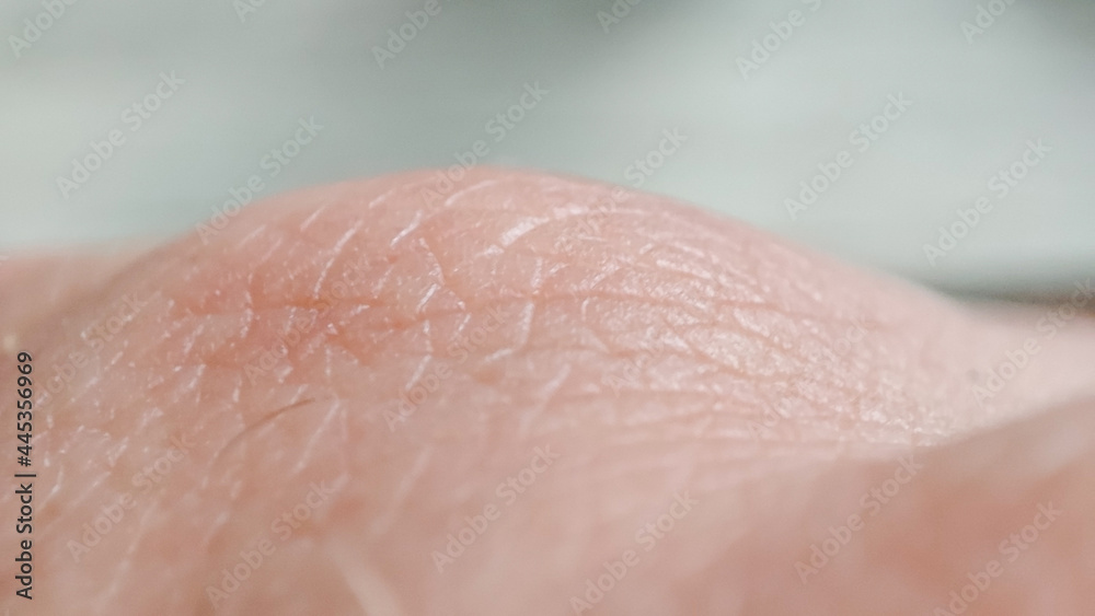 Fototapeta premium dermatology concept. Details of human skin background. Close-up skin dermatilis. Caucasian hand