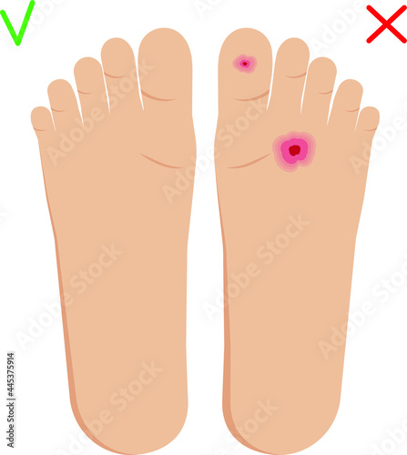 Vector illustration for design of podology