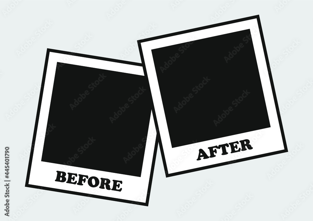 Fototapeta premium before after icon screen, icon vector