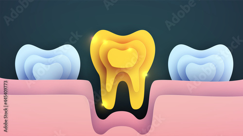 Golden tooth silhouette in modern creative style. Minimalistic luxury design concept. Premium healthcare medical composition art element. Bright paper cut layer vector illustration.