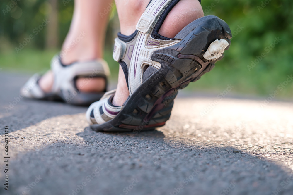 Chewing gum stuck to the soles of sandals on a summer day. 