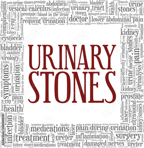 Urinary Stones vector illustration word cloud isolated on a white background.