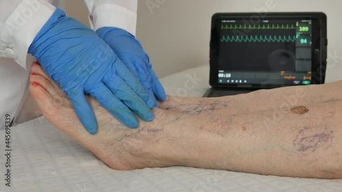 elderly patient at the doctor who checks her legs with many varicose veins