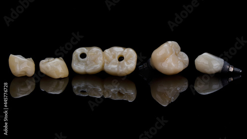 composition of beautiful dental ceramic crowns and inlays on black glass with reflection