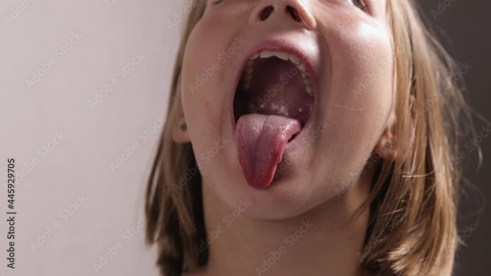 Girl of 9-10 years old at an appointment with a jaw surgeon or ...