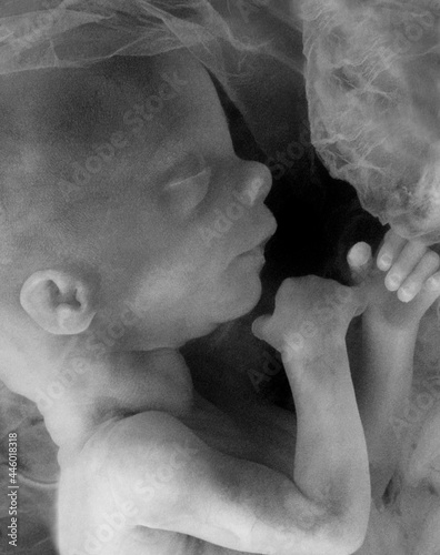 Fotografiet Human Fetus