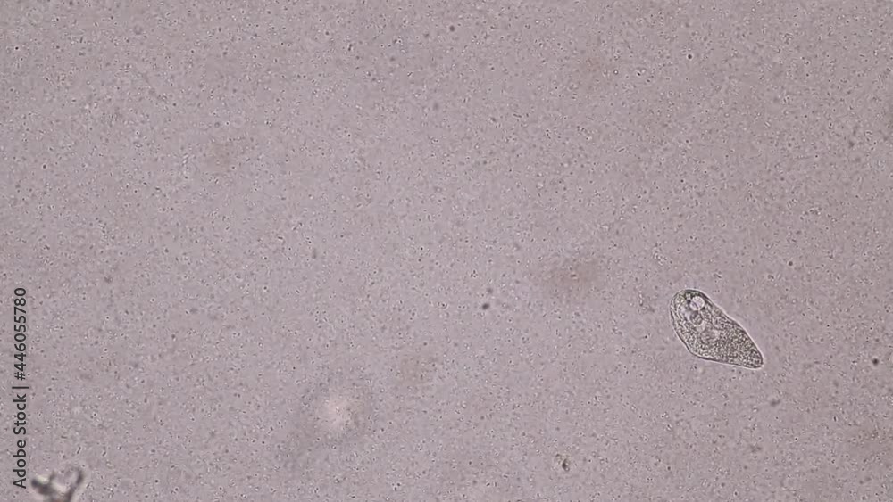 Bacteria and Protozoa in waste water under the microscope.
Bacteria and Protozoa in waste water under the microscope.