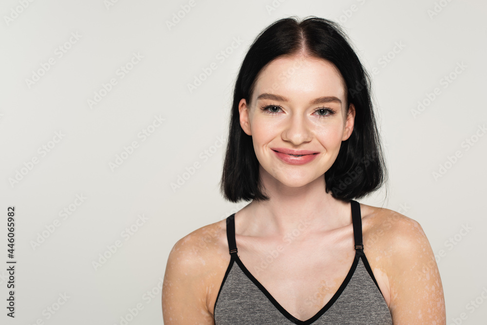 Sportswoman with vitiligo smiling at camera isolated on grey Sportswoman with vitiligo smiling at camera isolated on grey