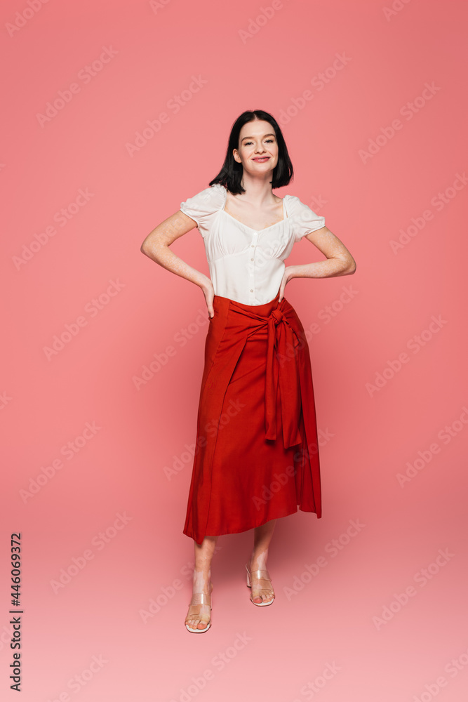 Stylish woman with vitiligo looking at camera on pink background Stylish woman with vitiligo looking at camera on pink background