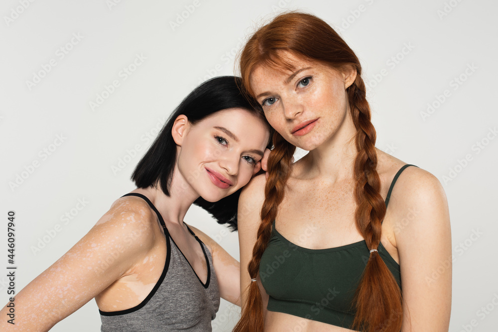 Smiling sportswoman with vitiligo standing near freckled friend isolated on grey