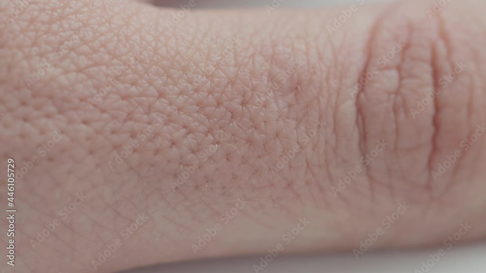pores on the skin of a finger in a person, close-up. Skin hydration and nutrition concept, dermatology, macro pores on the skin of a finger in a person, close-up. Skin hydration and nutrition concept, dermatology, macro