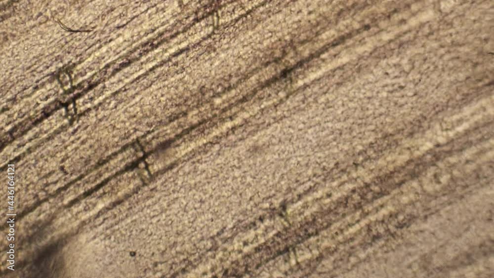 Blood cells stream through tiny blood vessels. Blood cells stream through tiny blood vessels.