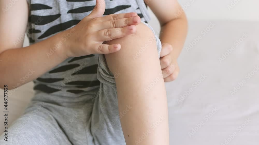 Little boy shows a scratch on his knee. Child's injury sustained in a fall. Damaged skin close-up. Little boy shows a scratch on his knee. Child's injury sustained in a fall. Damaged skin close-up.