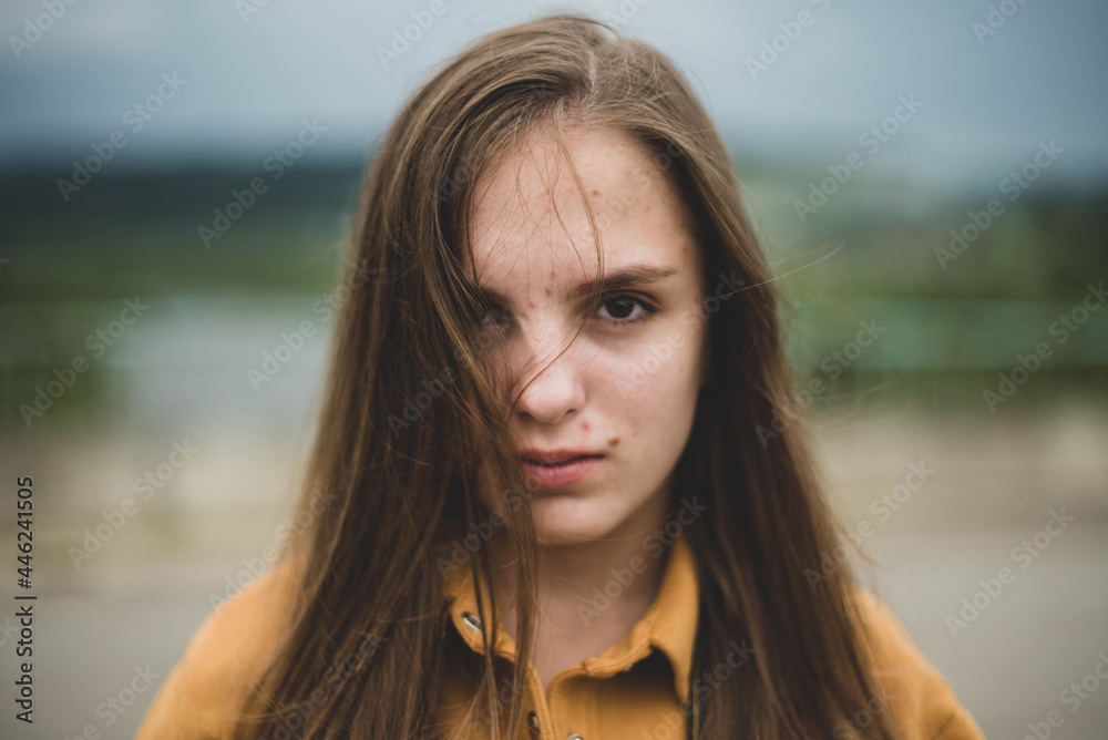 Portrait of young beautiful cute teenage girl woman with frackles and problematic skin on natural background. Girl power, body positive, real people. Portrait of young beautiful cute teenage girl woman with frackles and problematic skin on natural background. Girl power, body positive, real people.
