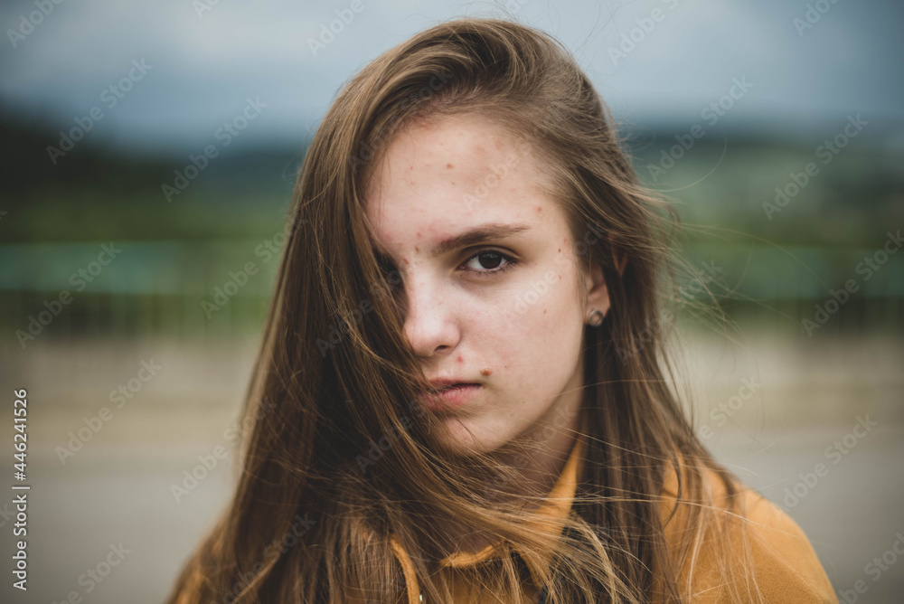 Portrait of young beautiful cute teenage girl woman with frackles and problematic skin on natural background. Girl power, body positive, real people. Portrait of young beautiful cute teenage girl woman with frackles and problematic skin on natural background. Girl power, body positive, real people.