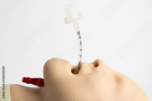 Pediatric endotracheal tube positioned. Airway management with ETT(endotracheal tube). Side view photo