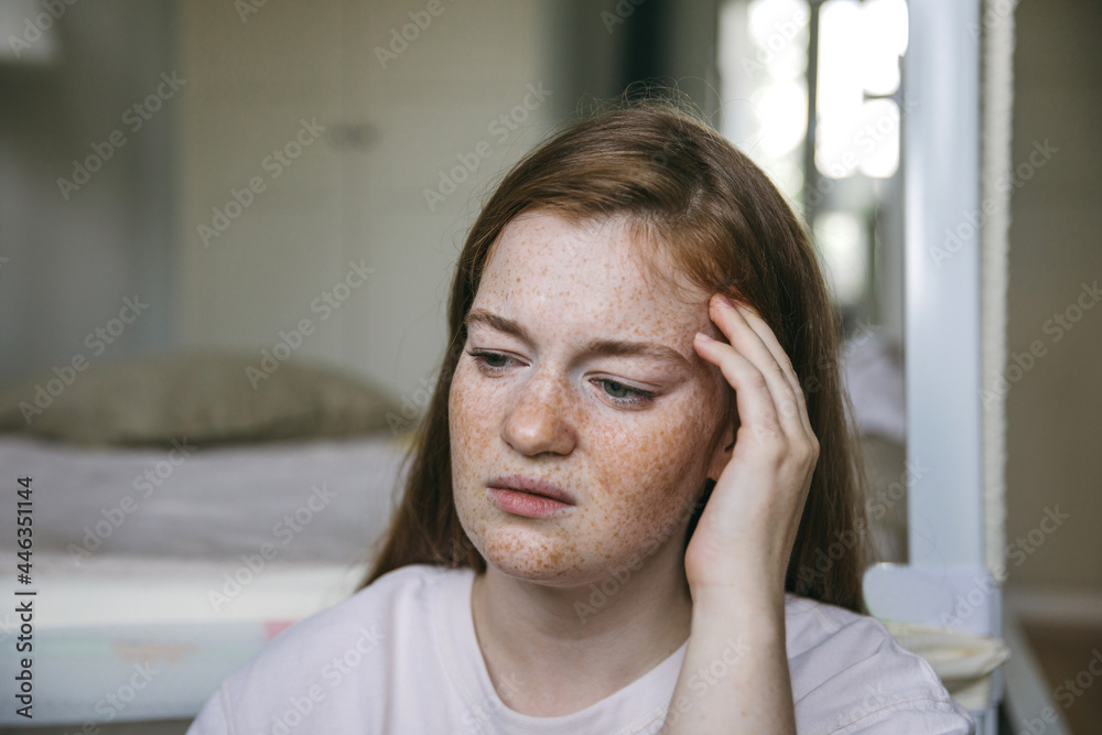 A young woman suffers from a headache, migraine. Consequences of covid A young woman suffers from a headache, migraine. Consequences of covid