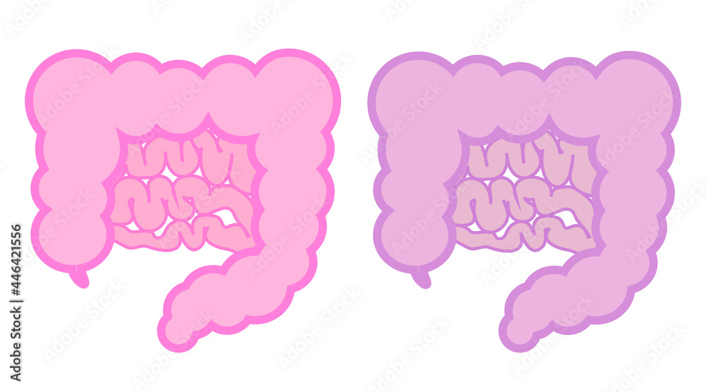 アウトラインのあるシンプルな腸のイラスト。健康なものと不健康なものの二つ。 アウトラインのあるシンプルな腸のイラスト。健康なものと不健康なものの二つ。