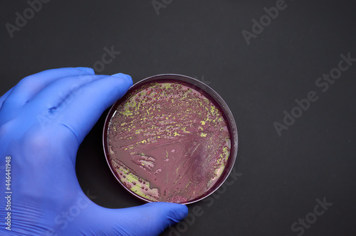 bacterial colonies of E coli on selective medium plate on black background photo