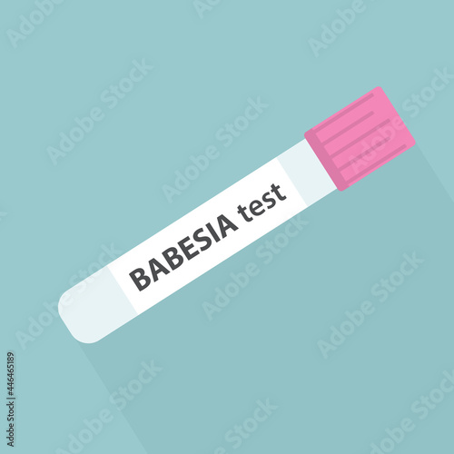 Babesia blood test- vector illustration photo