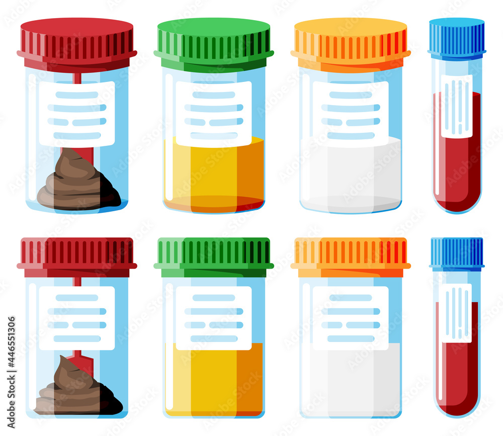 Test Tubes with Caps. Stool, Blood, Urine and Sperm. Medical Equipment. Specimen Cups for Gynecological Analysis. Plastic Containers with Biomaterial Analysis in Laboratory. Flat Vector Illustration Test Tubes with Caps. Stool, Blood, Urine and Sperm. Medical Equipment. Specimen Cups for Gynecological Analysis. Plastic Containers with Biomaterial Analysis in Laboratory. Flat Vector Illustration