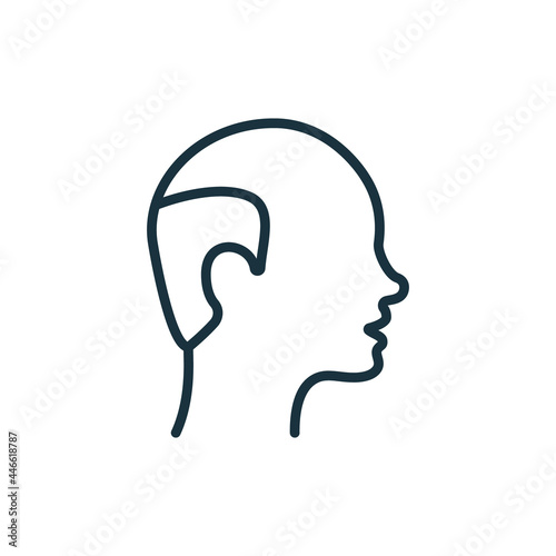 Hairless Male Line Icon. Bald Man Linear Pictogram. Hair Loss  Alopecia Medical Problem Outline Icon. Editable Stroke. Isolated Vector Illustration