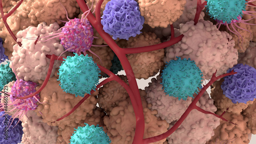 Tableau sur toile Tumor microenvironment, normal cells, molecules, and blood vessels that surround and feed a tumor cell