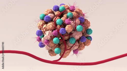 Tumor microenvironment, normal cells, molecules, and blood vessels that surround and feed a tumor cell. Microenvironment can affect how a tumor grows and spreads. photo