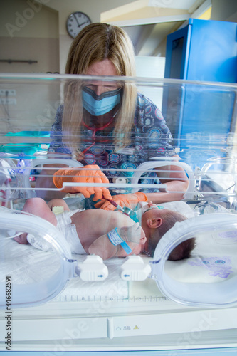 Noworodek w inkubatorze na oddziale neonatologii. Intensywna terapia.  photo