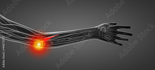 medical  illustration of the pronator teres photo