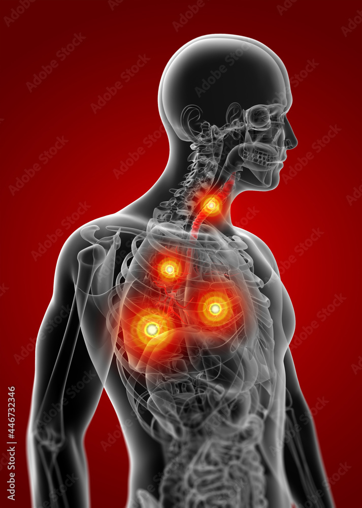 3d render lungs with visible bronchi - side view 3d render lungs with visible bronchi - side view