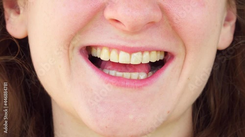 Adult fat girl smile and show tongue, throat. Happy woman close up. portrait with wide open mouth and protruding tongue. Show healthy yellow teeth to the dentist. Redhead girl with thin lips.