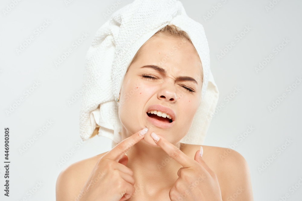 woman with a towel on her head holds a magnifying glass near face acne woman with a towel on her head holds a magnifying glass near face acne