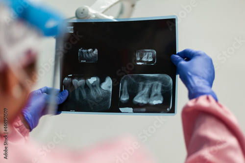 фотографія Dentist looks X-ray for diagnosis