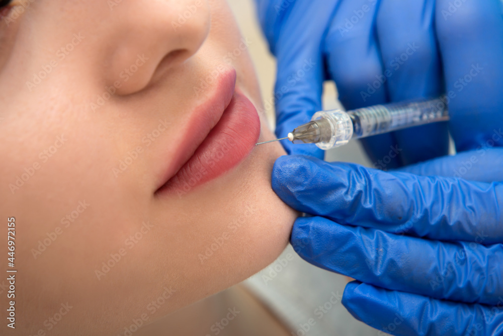 Hands of cosmetologist making injection in face, lips. Young woman gets beauty facial injections in salon. Face aging, rejuvenation and hydration procedures. Aesthetic cosmetology. Close up Hands of cosmetologist making injection in face, lips. Young woman gets beauty facial injections in salon. Face aging, rejuvenation and hydration procedures. Aesthetic cosmetology. Close up